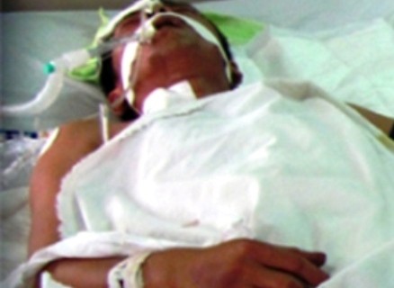 Anh Dương vẫn đang phải điều trị tại bệnh viện đa khoa tỉnh Hà Tĩnh trong tình trạng hôn mê sâu.